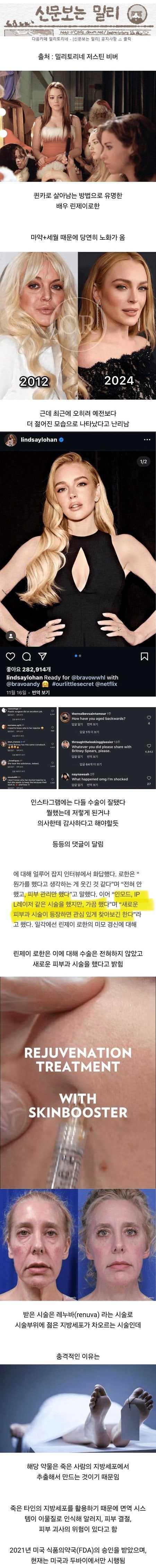 최근 할리우드 배우들이 받는다는 시술.jpg