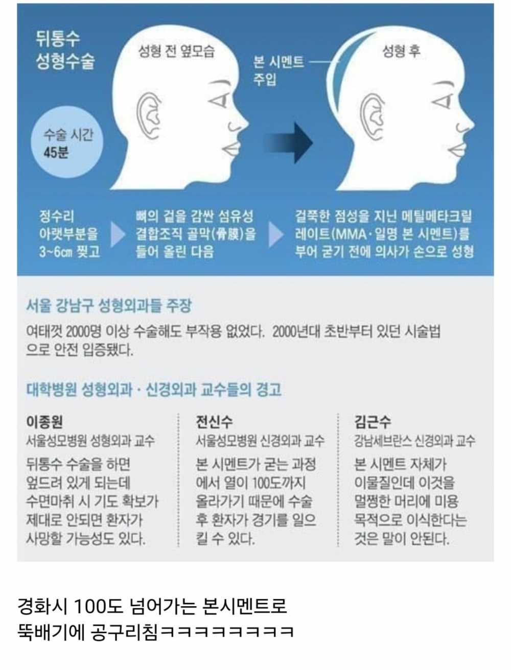 무시무시한 요즘 성형수술